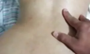 गुदा में पतन पत्नी,  ...